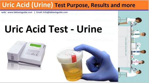 uric acid blood test bottle colour|uric acid levels in urine.